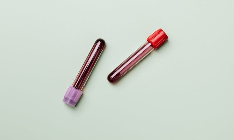 duas amostras de sangue para rastreio de IST