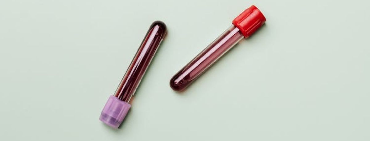 duas amostras de sangue para rastreio de IST